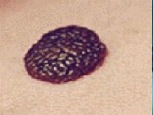 印度靶向药名称和医治领域及不良反响常识
