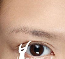 六步骤单眼皮肉泡眼瞬间变大