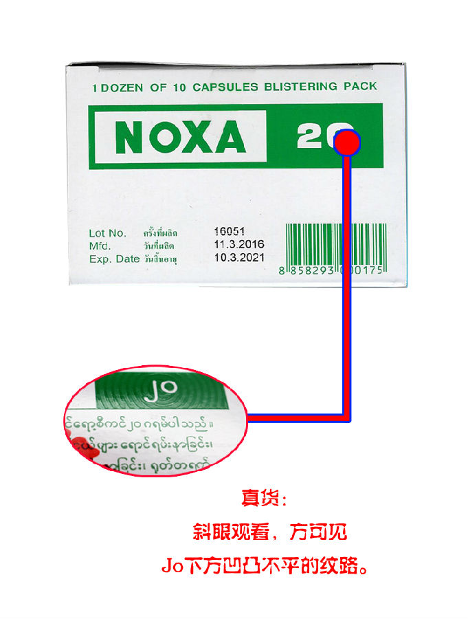 泰国娜莎/诺莎 NOXA20:推荐一款对痛风效果特别好的药给大家。